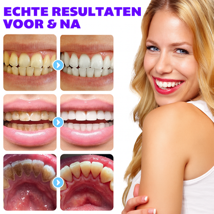 Ikzee Tandenbleek-, verfrissende Tabletten