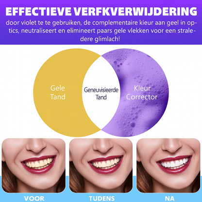 Ikzee Tandenbleek-, verfrissende Tabletten